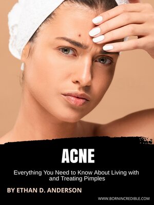 cover image of Acne